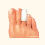 Предпазител за ноктите на пръстите на краката Pedag - Image 2